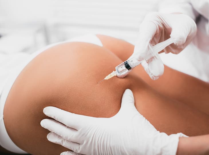 cellulite-injectable-img-1